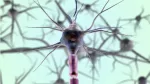 neuron-szklerozis-multiplex